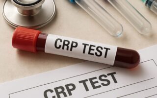 Crp Yüksekliği Hangi Doktora Gidilir?
