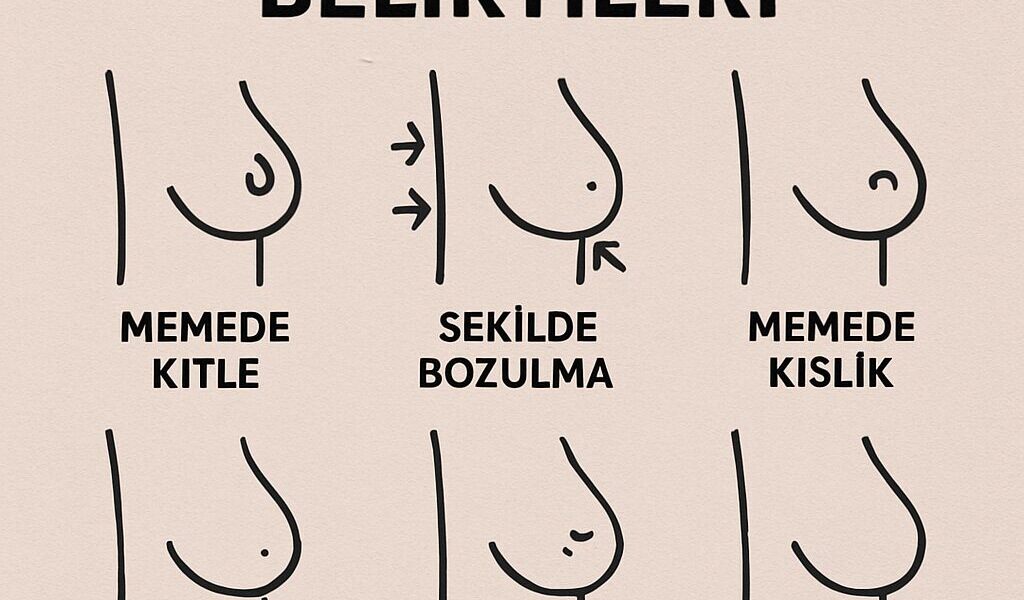 Meme Kanseri İçin Hangi Doktora Gidilir?