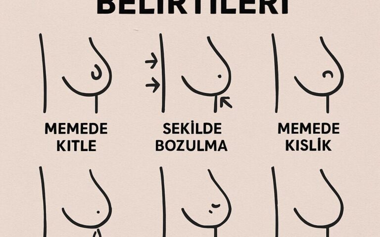 Meme Kanseri İçin Hangi Doktora Gidilir?