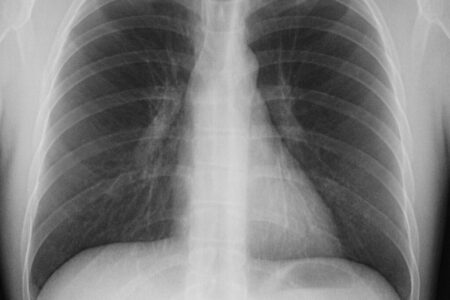 Akciğer Ağrısı İçin Hangi Doktora Gidilir?