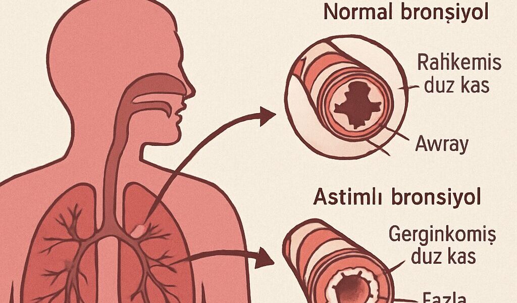 Astım İçin Hangi Doktora Gidilir?