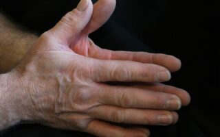 Kol Uyuşması İçin Hangi Doktora Başvurmalı?